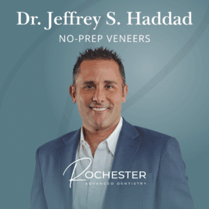 No prep